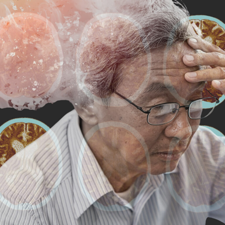 認識阿茲海默症